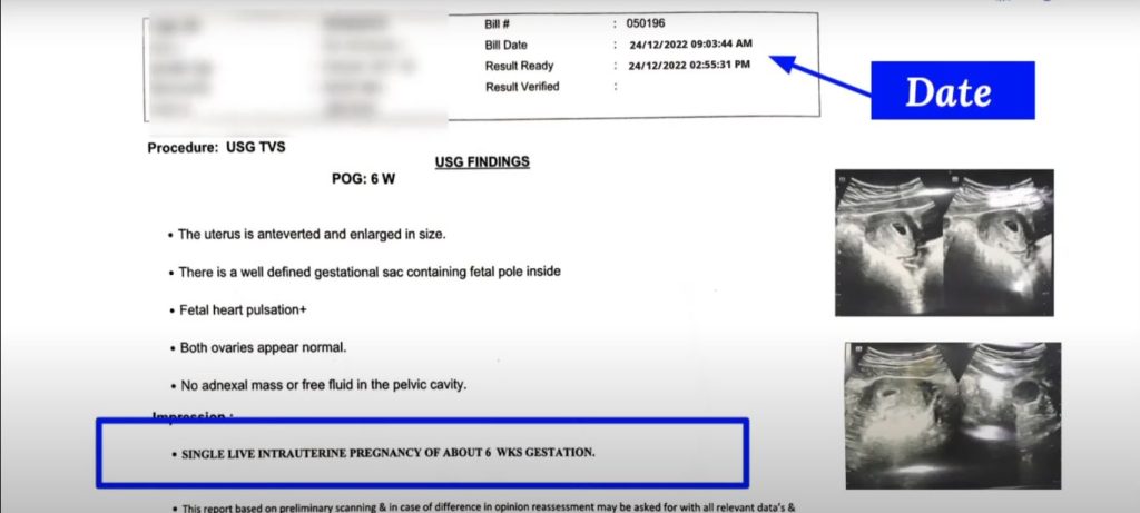 Ultrasound report before taking gestapro kit 